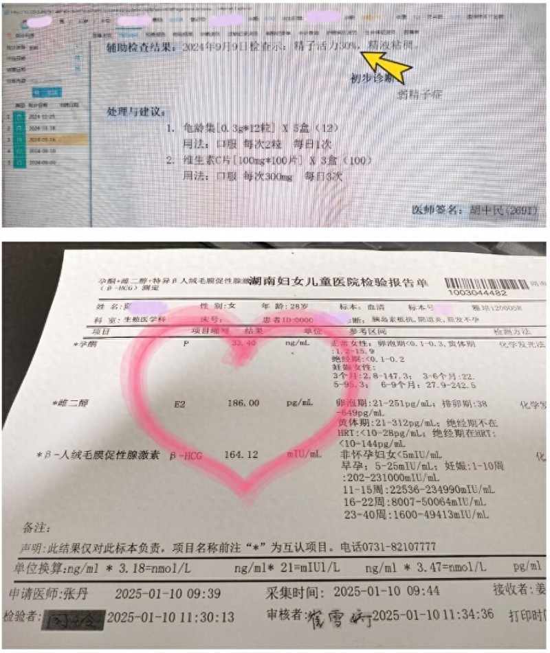 揭秘“人工授精”:最接近自然怀孕的辅助生殖技术